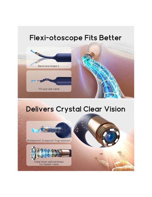 135R EAR CLEANING DEVICE CHARGING WITH CAMERA