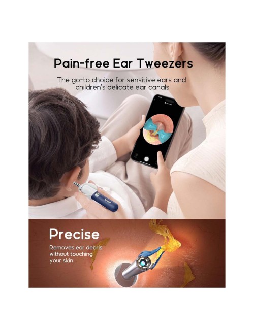 135R EAR CLEANING DEVICE CHARGING WITH CAMERA